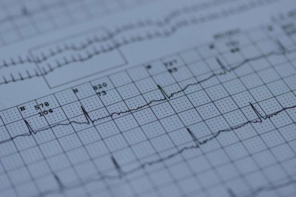 ECG webpage